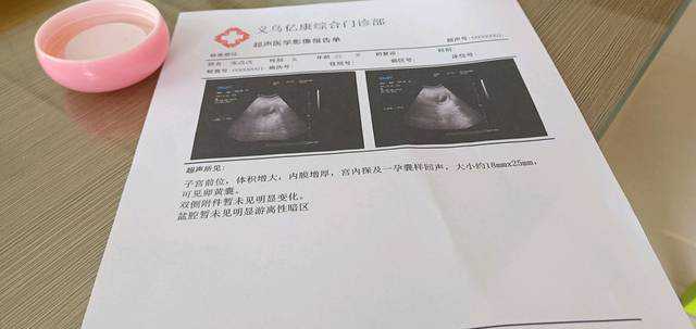 广州试管代孕中心，广州试管婴儿费用大概多少-广州三代试管婴儿费用