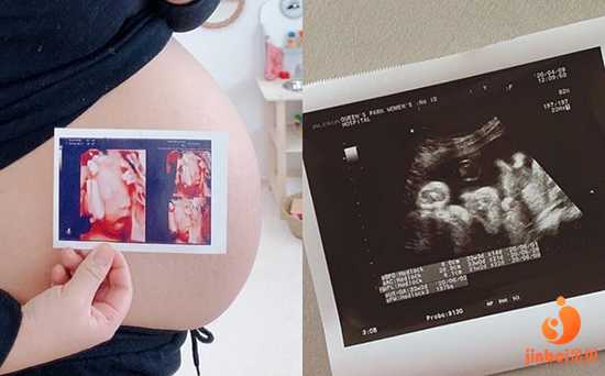 【上海仁济医院供卵电话】和姐妹们分享我的坎坷备孕之路（上）