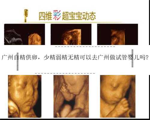 广州自精供卵，少精弱精无精可以去广州做试管婴儿吗?